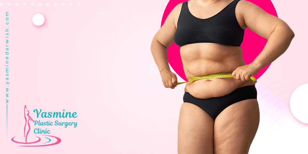 شد-الترهلات شد الترهلات